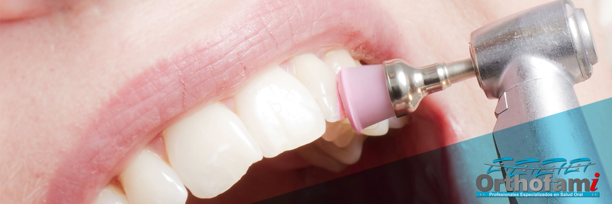 orthofami-ortodoncia-cali-odontologia-limpieza-dental-consulta-gratis-01 orthofami-ortodoncia-cali-odontologia-limpieza-dental-consulta-gratis-01