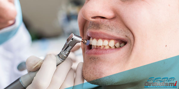 orthofami-ortodoncia-cali-odontologia-limpieza-dental-consulta-gratis-02 orthofami-ortodoncia-cali-odontologia-limpieza-dental-consulta-gratis-02